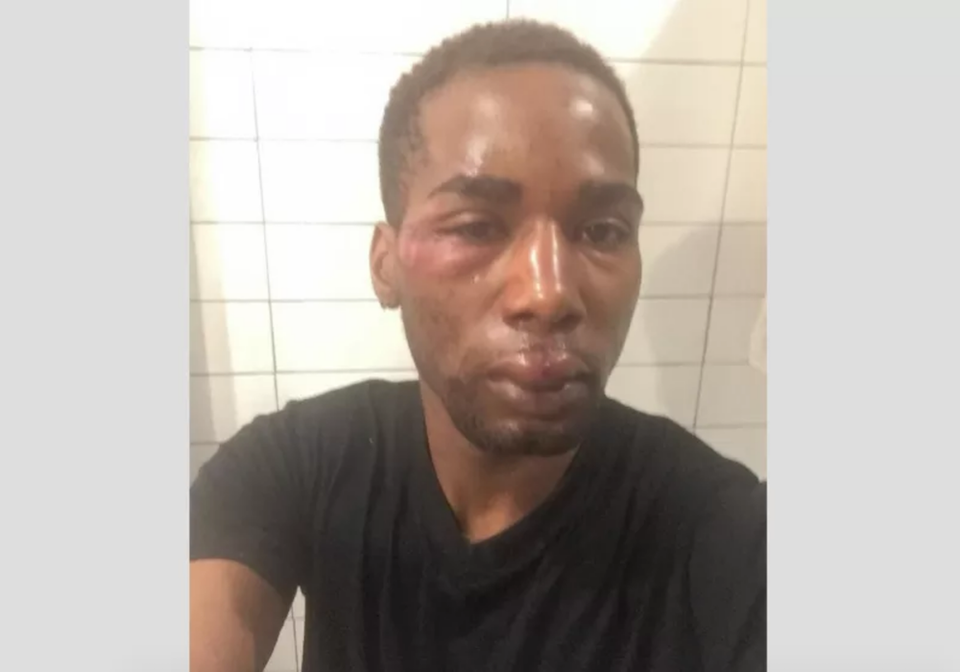 NYC Man Says A Restaurant Worker Called Him Racial Slurs And Beat Him